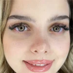 Aurora Troya Yıllık Lens - Görsel 3