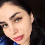 Medeo Giallo Haresiz Aylık Lens - Görsel 4